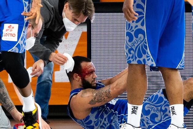 Rasheed Moore Fraport Skyliners 20 injured on the ground GER, Ratiopharm Ulm vs Fraport Skyliners, easycredit 1 Bundesliga Basketball, 4 Matchday, Season 2020 21, 02 02 2021 Ratiopharm Ulm vs Fraport Skyliners, Basketball New Ulm. Copyright: xEibner-Pressefoto RogerxBuerkex EP_EER