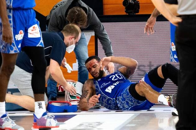Rasheed Moore Fraport Skyliners 20 injured on the ground GER, Ratiopharm Ulm vs Fraport Skyliners, easycredit 1 Bundesliga Basketball, 4 Matchday, Season 2020 21, 02 02 2021 Ratiopharm Ulm vs Fraport Skyliners, Basketball New Ulm. Copyright: xEibner-Pressefoto RogerxBuerkex EP_EER