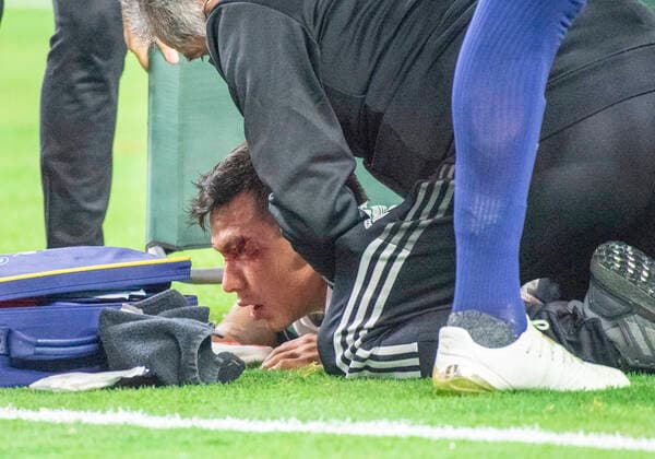 Jul 10, 2021: Mexico forward Hirving Lozano (22) lays on the field after receiving a laceration above his left eye in the first half during a CONCACAF Gold Cup game between Mexico and Trinidad & Tobago at AT&T Stadium in Arlington, TX Mexico and Trinidad & Tobago tied 0-0 CSM Arlington USA - ZUMAcp2_ 20210710_zaf_cp2_004 Copyright: xAlbertxPenax