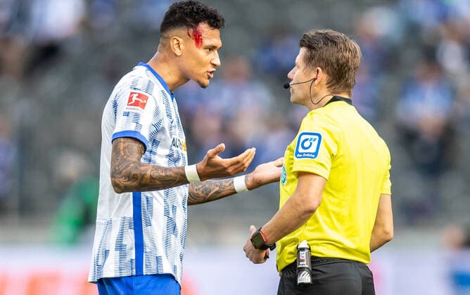 Bilder des Jahres 2021, Sport 10 Oktober Sport Themen der Woche KW39 Sport Bilder des Tages Berlin, 02.10.2021, Fussball, Bundesliga, 7. Spieltag, Hertha BSC - SC Freiburg, Olympiastadion. Berlins Davie Selke hat blutende Kopfwunde und spricht mit Schiedsrichter Patrick Ittrich (r). DFL regulations and DFB regulations prohibit any use of photographs as image sequences and or quasi-video, Foto: Andreas Gora Hertha BSC - SC Freiburg *** Berlin, 02 10 2021, Football, Bundesliga, Matchday 7, Hertha BSC SC Freiburg, Olympiastadion Berlins Davie Selke has bleeding head wound and talks to referee Patrick Ittrich r DFL regulations and DFB regulations prohibit any use of photographs as image sequences and or quasi video, Foto Andreas Gora Hertha BSC SC Freiburg