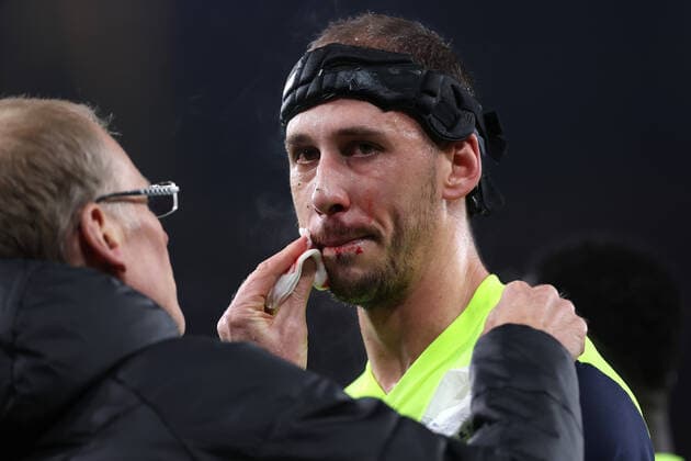 Arsenal gegen FC Zürich 03. November 2022, London UEFA Europa League Gruppenphase Arsenal gegen FC Zürich Nikola Katic von Zürich lässt sich Blut aus dem Gesicht entfernen Foto Jacques Feeney Offside London UK  Copyright: xJacquesxFeeneyx xOffsidexOffside