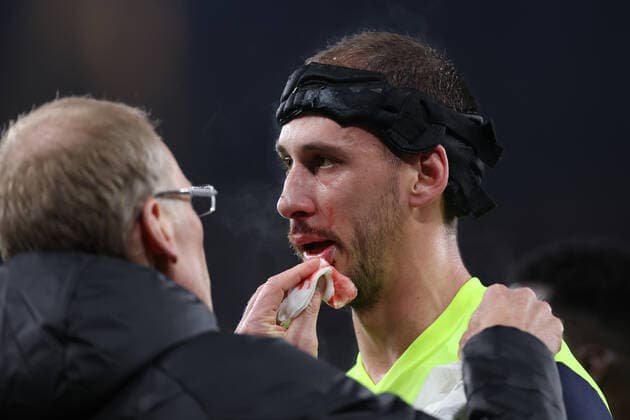 Arsenal gegen FC Zürich 03. November 2022, London UEFA Europa League Gruppenphase Arsenal gegen FC Zürich Nikola Katic von Zürich lässt sich Blut aus dem Gesicht entfernen Foto Jacques Feeney Offside London UK  Copyright: xJacquesxFeeneyx xOffsidexOffside