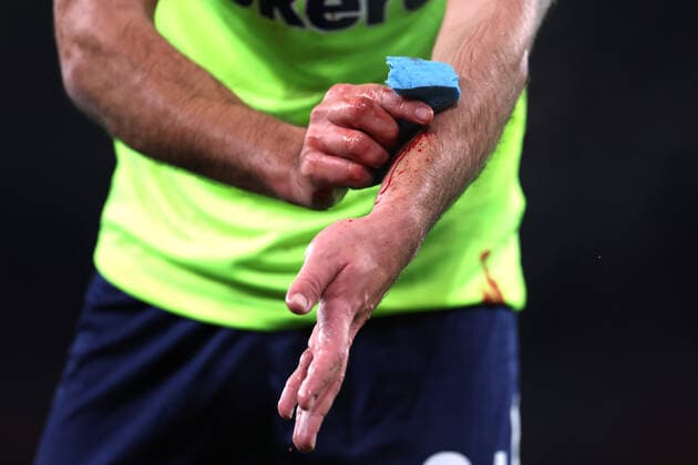 Arsenal gegen FC Zürich 03. November 2022, London UEFA Europa League Gruppenphase Arsenal gegen FC Zürich Nikola Katic von Zürich versucht, sich das Blut von den Armen zu waschen Foto Jacques Feeney Offside London UK  Copyright: xJacquesxFeeneyx xOffsidexOffside