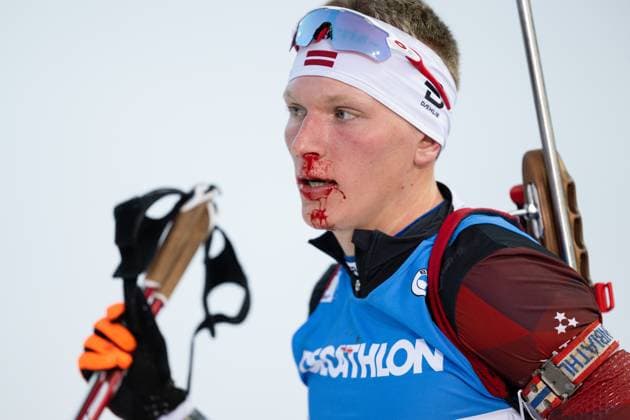 Sport Themen der Woche KW09 Sport Bilder des Tages 230302 Edgars Mise of Latvia after competing in men s 10km sprint during the IBU World Cup on March 2, 2023 in Nove Mesto na Morave. Photo: Joel Marklund BILDBYRAN kod JM JM0430 bbeng skidskytte biathlon skiskyting världscupen ibu world cup sprint blod skada depp näsblod *** 230302 Edgars Mise of Latvia after competing in mens 10km sprint during the IBU World Cup on March 2, 2023 in Nove Mesto na Morave Photo Joel Marklund BILDBYRAN code JM JM0430 bbeng biathlon biathlon biathlon world cup ibu world cup sprint blood injury depression nosebleed,  Copyright: JOELxMARKLUND BB230302JM047