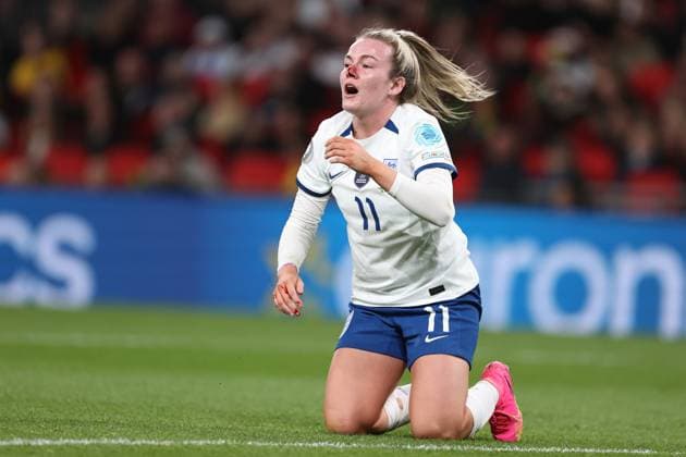 UEFA Women™s Finalissima 06 April 2023, Wembley UEFA Women™s Finalissima England gegen Brasilien Frauen Lauren Hemp aus England erleidet eine Schnittwunde an der Nase Foto Charlotte Wilson Offside London UK  Copyright: xCharlottexWilsonx xOffsidexOffside