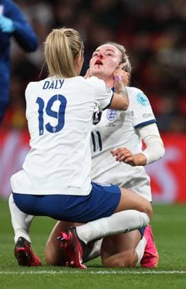 UEFA Women™s Finalissima 06 April 2023, Wembley UEFA Women™s Finalissima England gegen Brasilien Frauen Rachel Daly kümmert sich um die Engländerin Lauren Hemp, die eine Schnittwunde an der Nase erlitten hatte Foto Charlotte Wilson Offside London UK  Copyright: xCharlottexWilsonx xOffsidexOffside