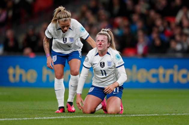 England Women v Brazil Women Womens Finalissima 2023 Lauren Hemp of England gets a bloody nose during the Womens Finalissima 2023 match between England Women and Brazil Women at Wembley Stadium, London Content Not Available For UK Newspapers Copyright: xPaulxChestertonx FIL-18329-0075 UK Newspapers OUT