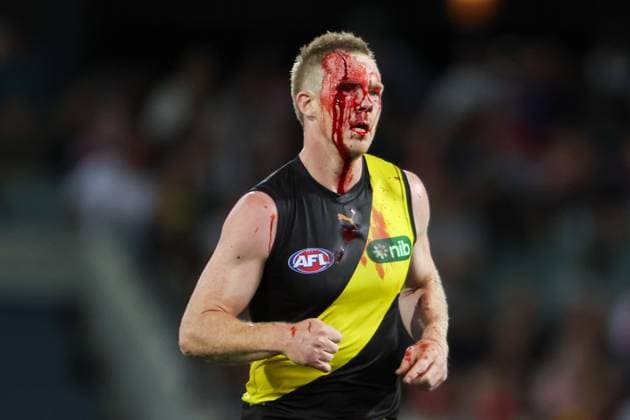 Sport Themen der Woche KW15 Sport Bilder des Tages AFL TIGERS SWANS, Jack Riewoldt of the Tigers leaves the field injured during the AFL Round 5 match between the Richmond Tigers and the Sydney Swans at the Adelaide Oval in Adelaide, Friday, April 14, 2023. ( NO ARCHIVING, EDITORIAL USE ONLY, NO USE IN BOOKS WITHOUT CONSENT ADELAIDE SOUTH AUSTRALIA AUSTRALIA  Copyright: xMATTxTURNERx 20230414001786327125
