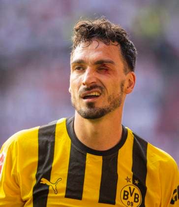 Sport Themen der Woche KW20 Augsburg, Germany. 21th Mai, 2023. Mats Hummels (BVB) mit blauem Auge FC Augsburg - Borussia Dortmund 21.05.2023 *** Augsburg, Germany May 21, 2023 Mats Hummels BVB with a black eye FC Augsburg Borussia Dortmund 21 05 2023