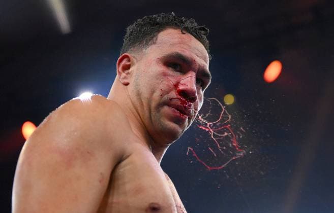 Sport Themen der Woche KW21 BOXING TSZYU BOMMBER, Louis Marsters reacts following his loss to David Nyika following their Cruiserweight bout at Margaret Court Arena in Melbourne, Wednesday, May 24, 2023. ( NO ARCHIVING, EDITORIAL USE ONLY, NO USE IN BOOKS WITHOUT CONSENT MELBOURNE VICTORIA AUSTRALIA  Copyright: xMORGANxHANCOCKx 20230524001802654854