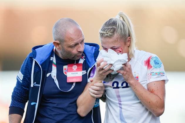 Sport Themen der Woche KW39 Sport Bilder des Tages Fotball, National League: Portugal - Norge Vila Boa, Portugal 20230926. Norges Sophie Haug hjelpes av banen med skade i fotballkampen i National League for kvinner mellom Portugal og Norge pa Estadio Cidade de Barcelos. Foto: Fredrik Varfjell NTB Vila Boa Portugal EDITORIAL USE ONLY. RESTRICTED USE FOR BETTING COMPANIES Ref:_SPOcGcnI96NLyw.jpg  Copyright: xFredrikxVarfjellx xNTBx