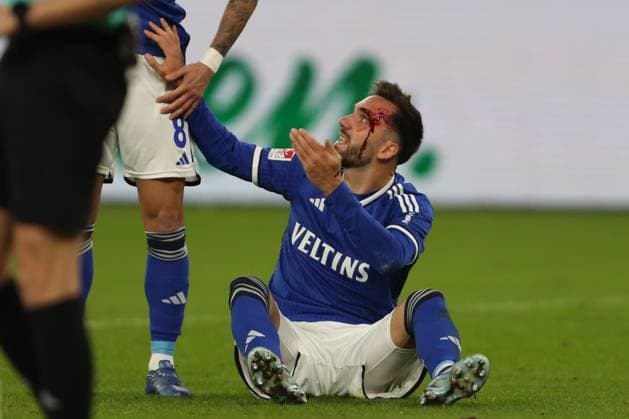 Sport Themen der Woche KW45 Sport Bilder des Tages Germany, Gelsenkirchen, 10.11.2023, Veltins-Arena, FC Schalke 04 vs SV Elversberg - 2. Bundesliga, Kenan Karaman (FC Schalke 04) injured on the ground, bleeds Gelsenkirchen Veltins-Arena North Rhine-Westfalia Germany *** Germany, Gelsenkirchen, 10 11 2023, Veltins Arena, FC Schalke 04 vs SV Elversberg 2 Bundesliga, Kenan Karaman FC Schalke 04 injured on the ground, bleeds Gelsenkirchen Veltins Arena North Rhine Westfalia Germany  eu-images-678