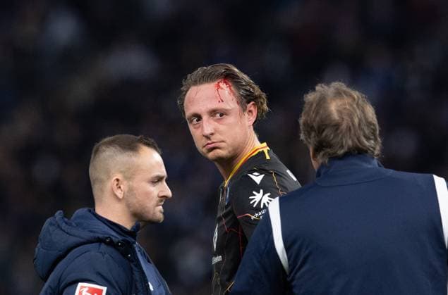Soccer, Men, Season 2023 2024, 2 Bundesliga 13 Matchday , Hertha BSC Karlsruher SC, Robin Bormuth Karlsruher SC with bleeding wound on the head 11 11 2023, Copyright: xSebastianxRäppold MatthiasxKochx