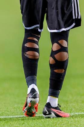 Europa League i fotball 2023: Molde - Qarabag (2-2) Molde 20231130. Qarabagspiller med hullete stromper under Europa League kampen i fotball mellom Molde og Qarabag pa Aker Stadion. Foto: Svein Ove Ekornesvag NTB Molde Norge EDITORIAL USE ONLY. RESTRICTED USE FOR BETTING COMPANIES Ref:_SPOyEH56HO3bSI.jpg  Copyright: xSveinxOvexEkornesvagx xNTBx