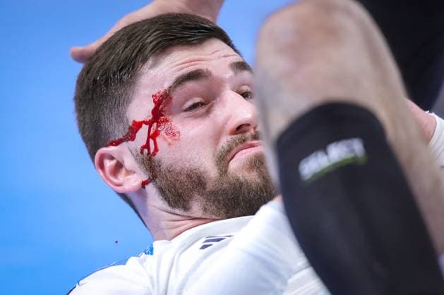 22 01 2024, EHF EURO 2024, European Mens Handball Championship, Lanxess Arena in Cologne, France Austria Shocking moment in the second half Ludovic Fabregas France lies on the floor with a bloody face Blood gushes from an injury to his face North Rhine-Westphalia Germany