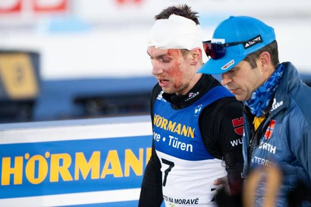 240218 Johannes Kuehn of Germany receives medical attention after competing in men s 15 km mass start during the IBU Biathlon World Championships on February 18, 2024 in Nove Mesto na Morave. Photo: Petter Arvidson BILDBYRAN kod PA PA0769 bbeng skidskytte biathlon skiskyting skidskytte-vm vm ibu world championships biathlon world championships dam women kvinner masstart mass start *** 240218 Johannes Kuehn of Germany receives medical attention after competing in mens 15 km mass start during the IBU Biathlon World Championships on February 18, 2024 in Nove Mesto na Morave Photo Petter Arvidson BILDBYRAN kod PA PA0769 bbeng biathlon biathlon biathlon biathlon biathlon world championships vm vm ibu world championships biathlon world championships dam women women kvinnor masstart mass start  Copyright: PETTERxARVIDSON BB240218PA266