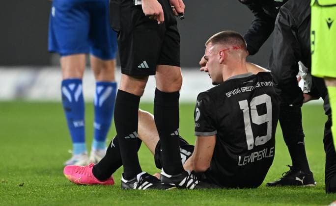 02 03 2024 Soccer Season 2023 2024 2 Soccer Bundesliga 24 Matchday Karlsruher SC Karlsruhe KSC SpVgg Greuther Fürth Kleeblatt Sportfoto Zink xwoxzix DFL regulations prohibit any use of photographs as image sequences and or quasi video only for editorial use Tim Lemperle 19, SpVgg Greuther Fürth battered on the ground