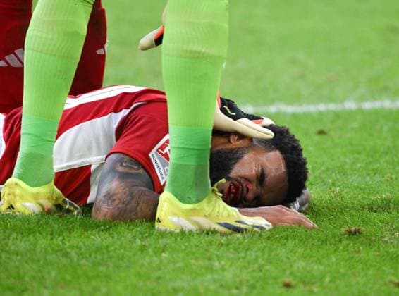 Injury Jamil Siebert Fortuna Duesseldorf 03 05 2024, Soccer 2 Bundesliga, 32 Matchday, Season 2023 2024 Fortuna Duesseldorf 1 FC Nürnberg 3 1 Duesseldorf North Rhine-Westphalia Germany Team2