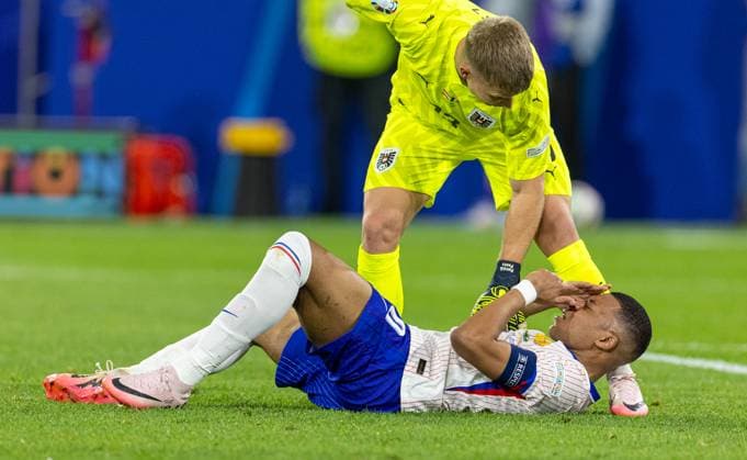 Football - UEFA EURO, EM, Europameisterschaft,Fussball 2024 - Group D - Austria v France DÜSSELDORF, GERMANY - Monday, June 17, 2024: France s captain Kylian MbappÃ with a bloody nose injury during the UEFA Euro 2024 Group D match between Austria and France at the Düsseldorf Arena. (Photo by David Rawcliffe Propaganda) DÜSSELDORF Düsseldorf Arena NORTH RHINE-WESTPHALIA GERMANY  Copyright: xDavidxRawcliffex P2024-06-17-Austria_France-73