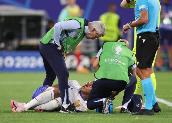 Dusseldorf, Germany, 17th June 2024. Kylan Mbappe of France injured with a bloody nose during the UEFA European Championships match at Dusseldorf Arena, Dusseldorf. Picture credit should read: David Klein Sportimage EDITORIAL USE ONLY. No use with unauthorised audio, video, data, fixture lists, club league logos or live services. Online in-match use limited to 120 images, no video emulation. No use in betting, games or single club league player publications. SPI-3197-0084