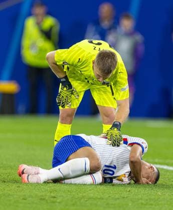 Football - UEFA EURO, EM, Europameisterschaft,Fussball 2024 - Group D - Austria v France DÜSSELDORF, GERMANY - Monday, June 17, 2024: France s captain Kylian MbappÃ with a bloody nose injury during the UEFA Euro 2024 Group D match between Austria and France at the Düsseldorf Arena. (Photo by David Rawcliffe Propaganda) DÜSSELDORF Düsseldorf Arena NORTH RHINE-WESTPHALIA GERMANY  Copyright: xDavidxRawcliffex P2024-06-17-Austria_France-75