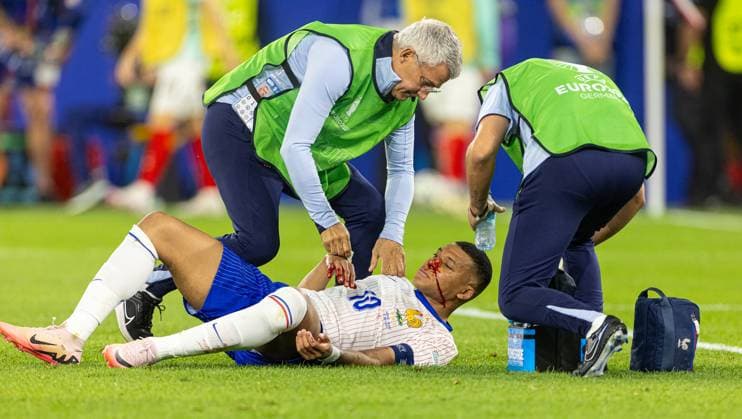 Football - UEFA EURO, EM, Europameisterschaft,Fussball 2024 - Group D - Austria v France DÜSSELDORF, GERMANY - Monday, June 17, 2024: France s captain Kylian MbappÃ with a bloody nose injury during the UEFA Euro 2024 Group D match between Austria and France at the Düsseldorf Arena. (Photo by David Rawcliffe Propaganda) DÜSSELDORF Düsseldorf Arena NORTH RHINE-WESTPHALIA GERMANY  Copyright: xDavidxRawcliffex P2024-06-17-Austria_France-79