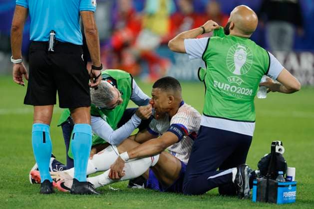 Austria v France: Group D - UEFA EURO, EM, Europameisterschaft,Fussball 2024 Kylian Mbappe of France is treated after injury during the UEFA EURO 2024 group stage match between Austria and France at Düsseldorf Arena on June 17, 2024 in Dusseldorf, Germany. Düsseldorf Düsseldorf Arena Germany Germany Copyright: xRichardxSellers Sportsphoto APLx 14041150