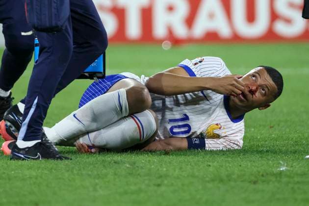 Kylian Mbappe France, 10 on the ground , Football, UEFA , European Championship, Group D 2024, Austria vs France, 17 06 2024, Duesseldorf Arena, Duesseldorf, Germany Duesseldorf Duesseldorf Arena Nordrhein Westfalen Germany Copyright: xGrantxHubbsx
