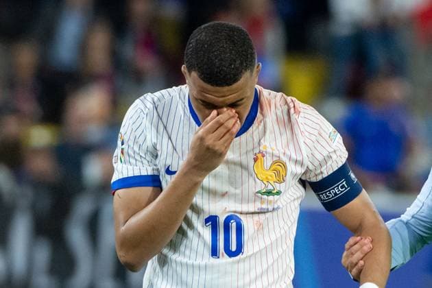 Kylian Mbappe France, 10 is injured and undergoing treatment, GER, Austria AUT vs France FRA , European Football Championship, UEFA EURO 2024, Group D, Matchday 1, 17 06 2024 GER, Austria AUT vs France FRA , European Football Championship, UEFA EURO 2024, Group D, Matchday 1, 17 06 2024 Duesseldorf Copyright: xEibner-Pressefoto Memmlerx EP_MMR
