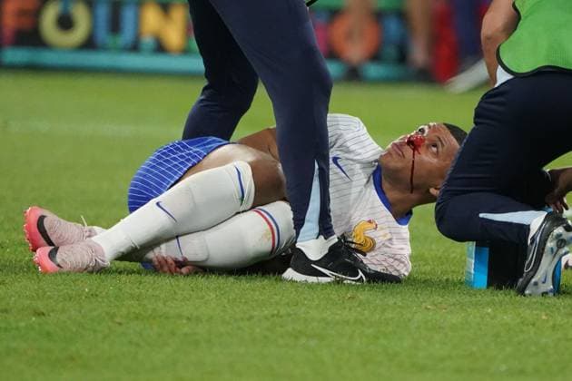 EURO 2024, football, UEFA Euro 2024, EM 2024, group stage, group D, Austria France, Düsseldorf Arena Düsseldorf, kylian mbappe France, nose injured, bleeding