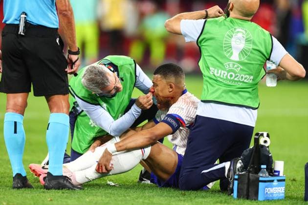 Österreich gegen Frankreich 17. Juni 2024, Düsseldorf UEFA EUROs Gruppe D Österreich gegen Frankreich Kylian Mbappe (Frankreich) wird wegen Nasenbluten von medizinischem Personal behandelt Foto Charlotte Wilson Abseits Düsseldorf Deutschland  Copyright: xCharlottexWilsonx xOffsidexOffside