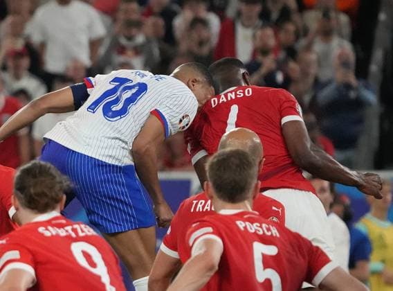 17 06 2024, Düsseldorf Arena, Düsseldorf, GER, EM UEFA 2024, Group D, Austria vs France, in the picture Kylian MbappÃ France is injured in a duel and has to be replaced with a bleeding nose Defodi 506 20240617 hbr 3759 Defodi-506