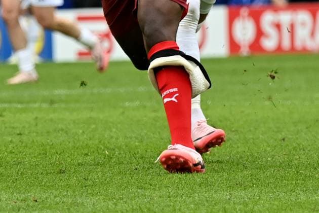 15 06 2024, xjrdrx, Football EM 2024, Hungary Switzerland emspor, v l Kurios Breel Donald Embolo Switzerland loses a bandage before the goal to 1 3 DFL DFB REGULATIONS PROHIBIT ANY USE OF PHOTOGRAPHS as IMAGE SEQUENCES and or QUASI VIDEO Köln
