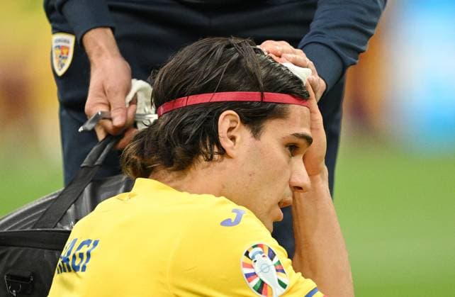 Germany Soccer Euro 2024 Romania - Netherlands 8721238 02.07.2024 Romania s Ianis Hagi receives medical attention after sustaining an injury during the UEFA EURO, EM, Europameisterschaft,Fussball 2024 round of 16 soccer match between Romania and Netherlands at the Munich Football Arena in Munich, Germany. Alexey Filippov Sputnik Munich Germany  Copyright: xAlexeyxFilippovx