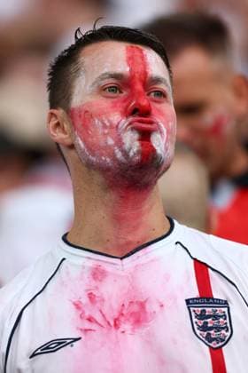 Niederlande gegen England 10. Juli 2024, Dortmund UEFA EUROs Halbfinale Niederlande gegen England Ein England-Fan mit Gesichtsbemalung, die auf sein Hemd gelaufen ist Foto Charlotte Wilson Abseits Dortmund Deutschland  Copyright: xCharlottexWilsonx xOffsidexOffside