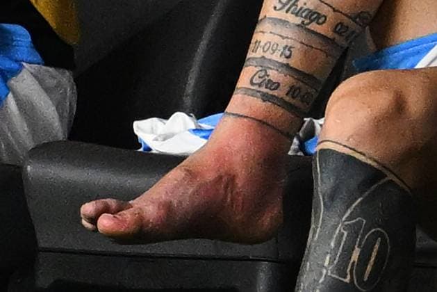 RECORD DATE NOT STATED Copa America USA 2024 Argentina vs Colombia - Final Ankle Lionel Messi of Argentina during Final match between Argentina and Colombia as part of CONMEBOL Copa America USA 2024 at Hard Rock Stadium on July 14, 2024 in Miami Gardens, Florida, United States. MIAMI GARDENS FLORIDA UNITED STATES  Copyright: xDavidxLeahx 20240714231140_CA_2024_F_ARG_COL_MESSI427