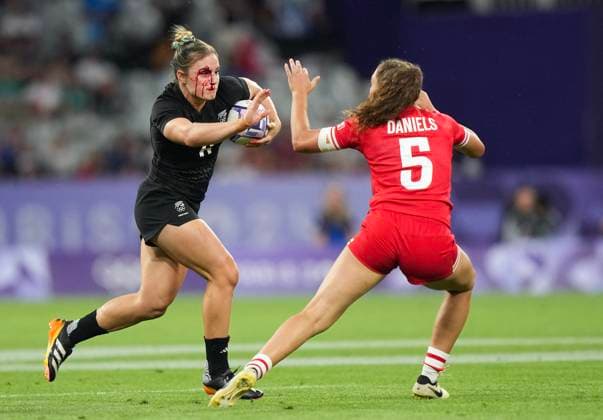 July 28, 2024, Paris, FRANCE: New Zealand back Michaela Blyde (6) runs with the ball with a bloodied face against Canada back Chloe Daniels (5) during second half women s rugby 7s action at the 2024 Summer Olympics in Paris, France on Sunday, July 28, 2024. Canada News - July 28, 2024  - ZUMAc35_ 20240728_zaf_c35_143 Copyright: xNathanxDenettex