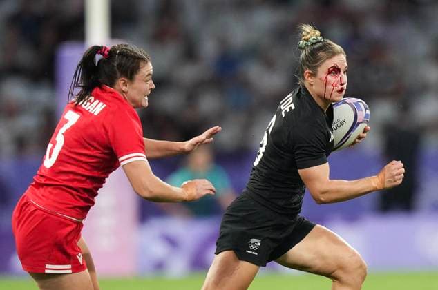 Bilder des Jahres 2024, Sport 07 Juli Sport Themen der Woche KW30 Sport Bilder des Tages July 28, 2024, Paris, FRANCE: New Zealand back Michaela Blyde (6) runs with the ball with a bloodied face against Canada forward Alysha Corrigan (3) during second half women s rugby 7s action at the 2024 Summer Olympics in Paris, France on Sunday, July 28, 2024. Canada News - July 28, 2024  - ZUMAc35_ 20240728_zaf_c35_144 Copyright: xNathanxDenettex