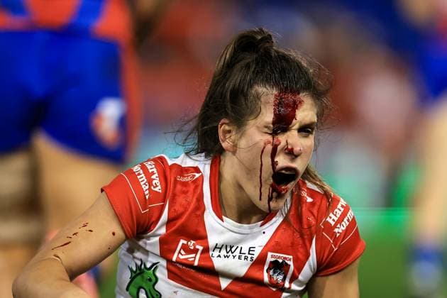 Sport Themen der Woche KW32 NRLW KNIGHTS DRAGONS, Shenai Lendill of the Dragons suffers from a head injury during the NRLW Round 3 match between the Newcastle Knights and St. George Illawarra Dragons at McDonald Jones Stadium in Newcastle, Sunday, August 11, 2024. ( NO ARCHIVING, EDITORIAL USE ONLY, NO USE IN BOOKS WITHOUT CONSENT NEWCASTLE NSW AUSTRALIA  Copyright: xMARKxEVANSx 20240811153440225540