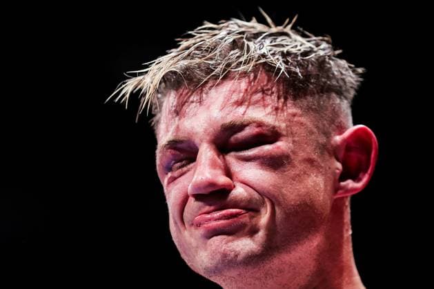 Sport Themen der Woche KW38 Sport Bilder des Tages UFC Fight Pass presents Boxing from the 3Arena, 3Arena, Dublin 20 9 2024 Emmett Brennan vs Kevin Cronin - Super Middleweight Celtic Title Kevin Cronin dejected after the fight Kevin Cronin dejected after the fight 20 9 2024  Copyright: x INPHO LaszloxGeczox LG_011592