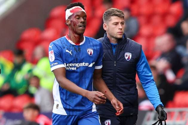 Bilder des Jahres 2024, Sport 09 September Sport Themen der Woche KW39 Sport Bilder des Tages Harvey Araujo of Chesterfield leaves the pitch covered in blood after a head injury Doncaster Rovers v Chesterfield, EFL Sky Bet League Two, Football, Eco-Power Stadium, Doncaster, UK, 28 Sep 2024 EDITORIAL USE ONLY No use with unauthorised audio, video, data, fixture lists, club league logos or live services. Online in-match use limited to 120 images, no video emulation. No use in betting, games or single club league player publications.  Copyright: xJakexKirkman Shutterstockx 14741410eg