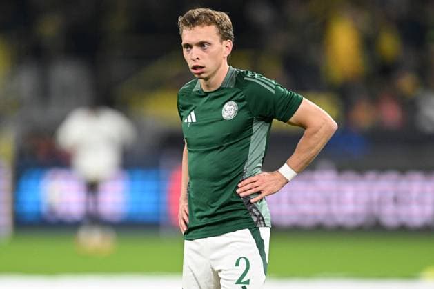 Alistair Johnston of Celtic during the pre-match warm up Borussia Dortmund v Celtic, UEFA Champions League, Group Stage, Football, Signal Iduna Park, Dortmund, Germany, 01 Oct 2024 EDITORIAL USE ONLY No use with unauthorised audio, video, data, fixture lists, club league logos or live services. Online in-match use limited to 120 images, no video emulation. No use in betting, games or single club league player publications. Copyright: xMichaelxTitgemeyer Shutterstockx 14750161e