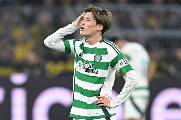 Kyogo Furuhashi of Celtic shows a look of dejection Borussia Dortmund v Celtic, UEFA Champions League, Group Stage, Football, Signal Iduna Park, Dortmund, Germany, 01 Oct 2024 EDITORIAL USE ONLY No use with unauthorised audio, video, data, fixture lists, club league logos or live services. Online in-match use limited to 120 images, no video emulation. No use in betting, games or single club league player publications. Copyright: xMichaelxTitgemeyer Shutterstockx 14750161cz