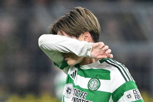 Kyogo Furuhashi of Celtic shows a look of dejection Borussia Dortmund v Celtic, UEFA Champions League, Group Stage, Football, Signal Iduna Park, Dortmund, Germany, 01 Oct 2024 EDITORIAL USE ONLY No use with unauthorised audio, video, data, fixture lists, club league logos or live services. Online in-match use limited to 120 images, no video emulation. No use in betting, games or single club league player publications. Copyright: xMichaelxTitgemeyer Shutterstockx 14750161cx