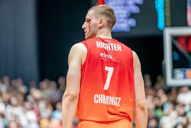 Bilder des Jahres 2024, Sport 11 November Sport Themen der Woche KW44 Sport Bilder des Tages Chemnitz, Deutschland 03. Oktober 2024: 1.BBL - 2024 2025 - Niners Chemnitz vs. BG Göttingen Im Bild: Jonas Richter (Chemnitz) am Kopf verletzt mit Blutung *** Chemnitz, Germany 03 October 2024 1 BBL 2024 2025 Niners Chemnitz vs BG Göttingen In the picture Jonas Richter Chemnitz injured on the head with bleeding Copyright: xFotostandx xNachtigallx