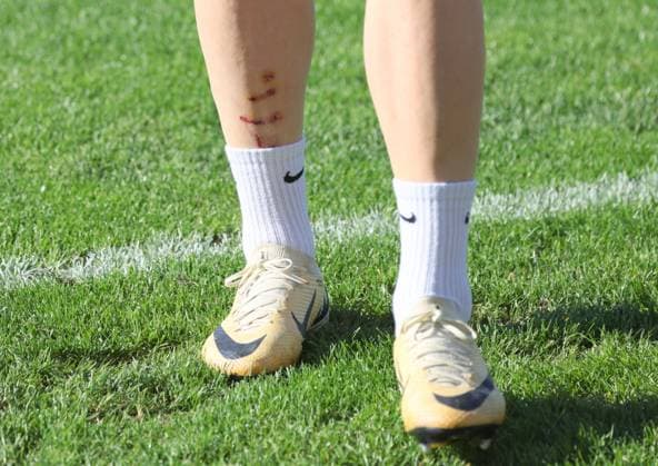 SOCCER - UEFA CL, Dortmund vs Sturm GRAZ,AUSTRIA,04.NOV.24 - SOCCER - UEFA Champions League, Borussia Dortmund vs SK Sturm Graz, preview, training Sturm. Image shows the injury of Dimitri Lavalee (Sturm).  GEPAxpictures xChrisxBauer