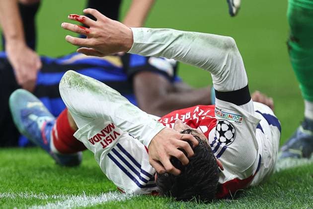 Sport Bilder des Tages Kai Havertz of Arsenal sustains a bloody head injury Inter Milan v Arsenal, UEFA Champions League, Group Stage, Football, San Siro Stadium, Milan, Italy - 06 Nov 2024 EDITORIAL USE ONLY No use with unauthorised audio, video, data, fixture lists, club league logos or live services. Online in-match use limited to 120 images, no video emulation. No use in betting, games or single club league player publications.  Copyright: xMarcoxCanienero Shutterstockx 14863816bf