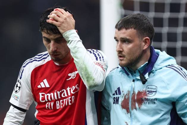 Kai Havertz of Arsenal sustains a bloody head injury Inter Milan v Arsenal, UEFA Champions League, Group Stage, Football, San Siro Stadium, Milan, Italy - 06 Nov 2024 EDITORIAL USE ONLY No use with unauthorised audio, video, data, fixture lists, club league logos or live services. Online in-match use limited to 120 images, no video emulation. No use in betting, games or single club league player publications.  Copyright: xMarcoxCanienero Shutterstockx 14863816bi