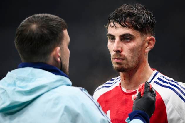 FC Internazionale v Arsenal FC - UEFA Champions League Kai Havertz of Arsenal FC bleeds after an injury during the UEFA Champions League 2024 25 league phase football match between FC Internazionale and Arsenal FC. Milan Italy Copyright: xNicolòxCampox