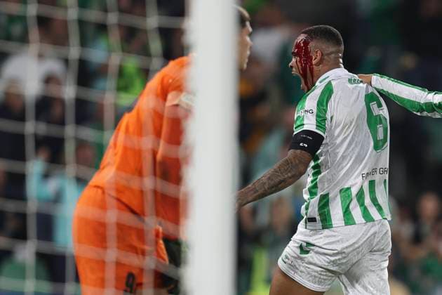 Bilder des Jahres 2024, Sport 11 November Sport Themen der Woche KW45 ESP: Real Betis - NK Celje. UEFA Conference League. Natan Souza of Real Betis injury during the UEFA Conference League match between Real Betis and NK Celje played at Benito Villamarin Stadium on November 7 2024 in Sevilla, Spain. kpng Copyright: xAntonioxPozox xPRESSINPHOTOx AP_241107_BET_CEL_021